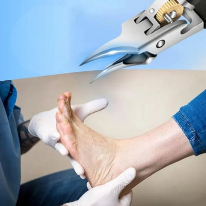 Cążki do paznokci zaprojektowane przez podologa – bezpiecznie i łatwo radzą sobie z wrastającymi, zgrubiałymi oraz zainfekowanymi grzybicą paznokciami.